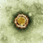 A electron microscope image of a coronavirus is seen in this undated picture provided by the Health Protection Agency in London